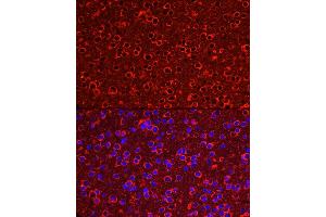 Immunofluorescence analysis of Mouse brain using P2Y12 antibody (ABIN7269752) at dilution of 1:50 (40x lens). (P2RY12 antibody)