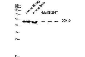 Western Blot (WB) analysis of Mouse Kidney Mouse Brain HeLa KB 293T lysis using COX10 antibody. (COX10 antibody  (Internal Region))