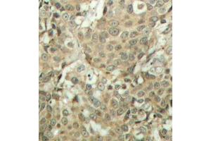 Immunohistochemistry (IHC) image for anti-Cofilin 1 (CFL1) (pSer3) antibody (ABIN3019729) (Cofilin antibody  (pSer3))