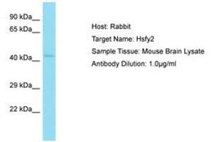 HSFY2 antibody  (AA 227-276)