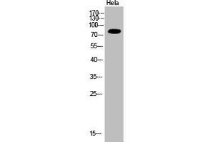 Western Blot analysis of Hela cells using Acetyl-Ub (K33) Polyclonal Antibody (UBA52/RPS27A/UBB/UBC (acLys33) antibody)