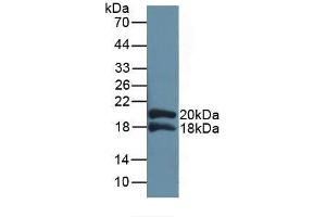 Detection of Recombinant IL1RAP, Human using Polyclonal Antibody to Interleukin 1 Receptor Accessory Protein (IL1RAP) (IL1RAP antibody  (AA 420-558))