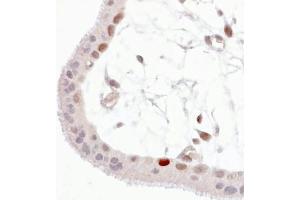 Immunohistochemistry staining of Wild-type p53 expressed in human trophoblast (paraffin-embedded sections).