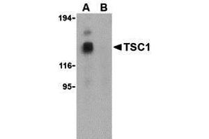 Western Blotting (WB) image for anti-Tuberous Sclerosis 1 (TSC1) (Middle Region) antibody (ABIN1031146) (TSC1 antibody  (Middle Region))