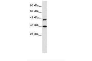 Image no. 1 for anti-D4, Zinc and Double PHD Fingers Family 1 (DPF1) (AA 229-278) antibody (ABIN6735926) (DPF1 antibody  (AA 229-278))