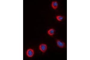 Immunofluorescent analysis of COX4-2 staining in K562 cells. (COX4I2 antibody)