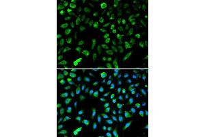 Immunofluorescence analysis of A549 cells using NME1 antibody.
