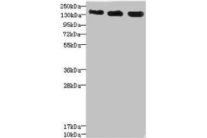 ANKS1B antibody  (AA 999-1248)