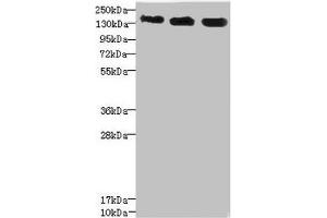 Western blot All lanes: ANKS1B antibody at 5. (ANKS1B antibody  (AA 999-1248))