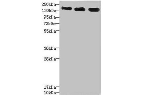 ANKS1B Antikörper  (AA 999-1248)