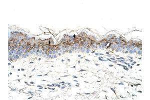 GEM antibody was used for immunohistochemistry at a concentration of 4-8 ug/ml to stain Squamous epithelial cells (arrows) in Human Skin. (GEM antibody  (C-Term))