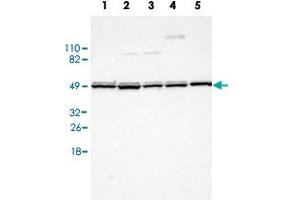 Western Blot analysis of (1) Human RT-4 cell, (2) Human U-251MG sp cell, (3) Human A-431 cell, (4) Human liver tissue, (5) Human tonsil tissue. (UQCRC1 antibody)