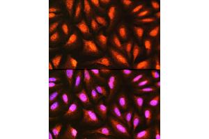 Immunofluorescence analysis of U-2 OS cells using MDFI Rabbit pAb (ABIN6128316, ABIN6143663, ABIN6143664 and ABIN6217803) at dilution of 1:100 (40x lens). (MDFI antibody  (AA 1-160))