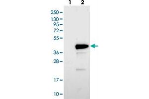 Western blot analysis of Lane 1: Negative control (vector only transfected HEK293T lysate). (BCL2L14 antibody)