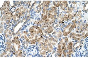 Human kidney (VMA21 antibody  (N-Term))