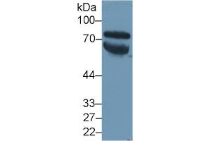 Detection of VTN in Human Serum using Polyclonal Antibody to Vitronectin (VTN) (Vitronectin antibody  (AA 19-468))