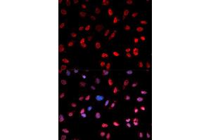 Immunofluorescence analysis of MCF7 cell using Phospho-ATF2-T53 antibody. (ATF2 antibody  (pThr71))
