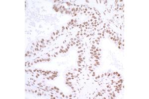 Immunohistochemistry (IHC) image for anti-Ubiquitin Specific Peptidase 7 (Herpes Virus-Associated) (USP7) (AA 1-50) antibody (ABIN7453991) (Recombinant USP7 antibody  (AA 1-50))