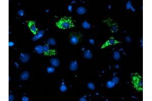 Anti-NDUFA5 mouse monoclonal antibody (ABIN2455255) immunofluorescent staining of COS7 cells transiently transfected by pCMV6-ENTRY NDUFA5 (RC201539). (NDUFA5 antibody  (AA 3-116))