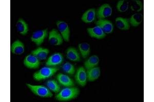 Immunofluorescent analysis of A549 cells using ABIN7161610 at dilution of 1:100 and Alexa Fluor 488-congugated AffiniPure Goat Anti-Rabbit IgG(H+L) (NINJ1 antibody  (AA 1-80))