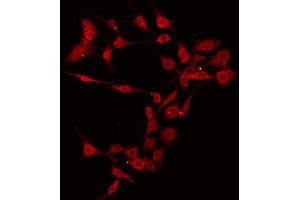 ABIN6266499 staining 293 by IF/ICC. (BAK1 antibody  (N-Term))