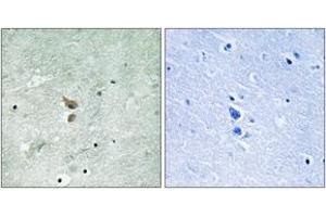 Immunohistochemistry analysis of paraffin-embedded human brain, using RIPK2 (Phospho-Ser176) Antibody. (RIPK2 antibody  (pSer176))