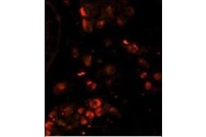 Immunofluorescence analysis of LIN28A Monoclonal Antibody with paraffin-embedded human testis tissue. (LIN28A antibody)
