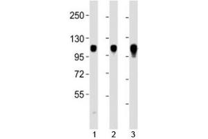 Western blot testing of Integrin alpha 7 antibody at 1:2000 dilution. (ITGA7 antibody  (C-Term))