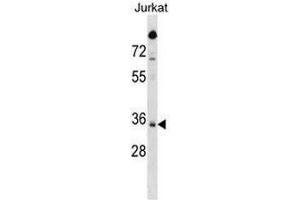 SNAPC2 Antibody (C-term) western blot analysis in Jurkat cell line lysates (35µg/lane). (SNAPC2 antibody  (C-Term))