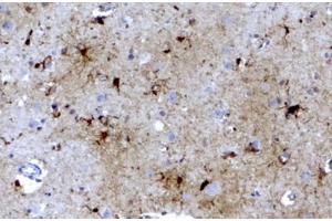 ABIN334402 (3. (FTL antibody  (C-Term))
