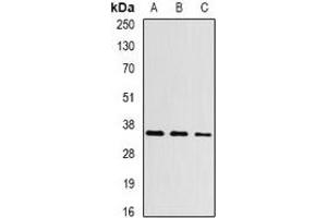 Western blot analysis of Aspartoacylase expression in Hela (A), mouse kidney (B), rat kidney (C) whole cell lysates. (ASPA antibody)