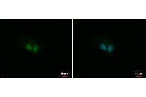 ICC/IF Image IP3KC antibody [N3C2], Internal detects IP3KC protein at nucleus by immunofluorescent analysis. (ITPKC antibody)