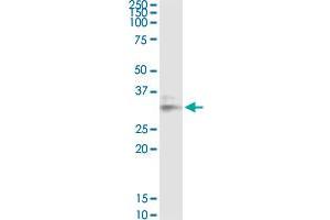 LGALS8 antibody  (AA 1-358)