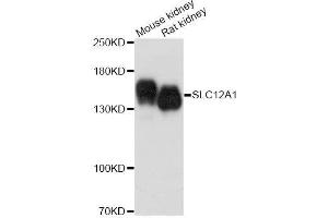 Western blot analysis of extracts of various cell lines, using SLC12A1 antibody. (SLC12A1 antibody  (AA 50-150))