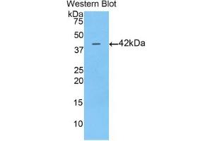 Detection of Recombinant AFP, Pig using Polyclonal Antibody to Alpha-Fetoprotein (AFP) (alpha Fetoprotein antibody  (AA 263-386))
