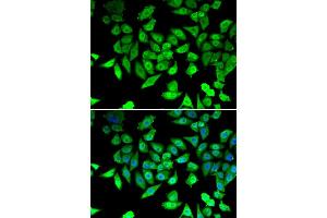 Immunofluorescence analysis of U20S cell using CCAR2 antibody. (CCAR2 antibody)