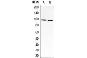Western blot analysis of CLCN6 expression in HEK293A (A), Jurkat (B) whole cell lysates. (CLCN6 antibody  (Center))