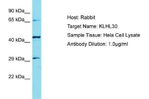 Host: Rabbit Target Name: KLHL30 Sample Tissue: Human Hela Whole Cell Antibody Dilution: 1ug/ml (KLHL30 antibody  (C-Term))