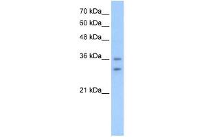 OR6C70 antibody used at 2. (OR6C70 antibody  (C-Term))