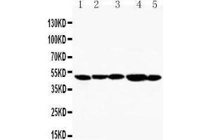 Anti-TIM 1 antibody, Western blotting Lane 1: SMMC Cell Lysate Lane 2: HELA Cell Lysate Lane 3: PANC Cell Lysate Lane 4: MM231 Cell Lysate Lane 5: MM453 Cell Lysate
