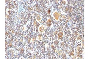 Image no. 2 for anti-B-Cell CLL/lymphoma 6 (BCL6) antibody (ABIN6175703) (BCL6 antibody)