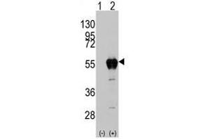 Image no. 2 for anti-Aldehyde Dehydrogenase 2 Family (Mitochondrial) (ALDH2) (AA 325-355) antibody (ABIN356918) (ALDH2 antibody  (AA 325-355))