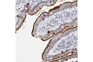Immunohistochemical staining of human duodenum with MGAM polyclonal antibody  shows strong membranous and moderate cytoplasmic positivity in glandular cells. (AGLU antibody)