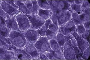 Immunofluorescent staining of Human Endothelial cells with anti-EBP50. (SLC9A3R1 antibody  (AA 128-249))