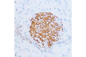 Immunohistochemistry of paraffin-embedded mouse pancreas using NOTCH3 antibody (ABIN6134401, ABIN6144738, ABIN6144739 and ABIN6217553) at dilution of 1:100 (40x lens). (NOTCH3 antibody  (C-Term))