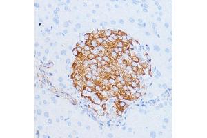 Immunohistochemistry of paraffin-embedded mouse pancreas using NOTCH3 antibody (ABIN6134401, ABIN6144738, ABIN6144739 and ABIN6217553) at dilution of 1:100 (40x lens).