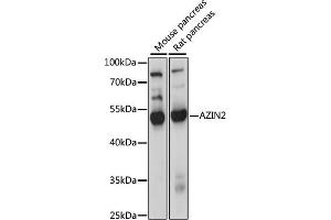 Western blot analysis of extracts of various cell lines, using  antibody (ABIN7265663) at 1000 dilution.