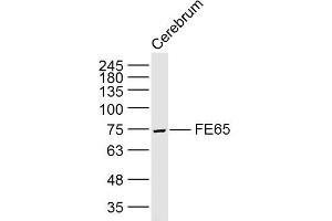 Lane 1: Rat cerebrum lysates probed with FE65 Polyclonal Antibody, Unconjugated (bs-0110R) at 1:300 overnight at 4˚C. (FE65 antibody  (AA 201-300))