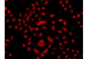 Immunofluorescence analysis of A549 cells using FBXW11 antibody (ABIN5975739). (FBXW11 antibody)