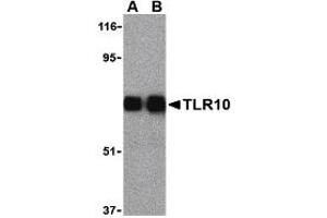 Western Blotting (WB) image for anti-Toll-Like Receptor 10 (TLR10) (Middle Region) antibody (ABIN1031128) (TLR10 antibody  (Middle Region))